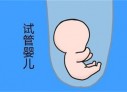 培养长沙捐卵宝宝艺术细胞的小技巧
